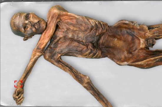 Az Ötzi csuklóján található tetoválás