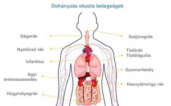 dohányzást okozó betegségek)