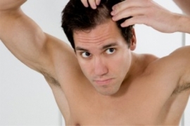kopaszodás hajhullás hajátültetés hajbeültetés hairhungary kevesebb hajszál hajritkulás tarság kopasz fej nagy változás